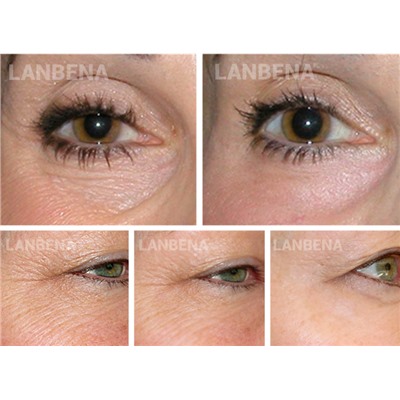 35%+SALE! LANBENA Маски-патчи против морщин с ретинолом, повышающие эластичность кожи контура глаз, 90гр, 50шт.