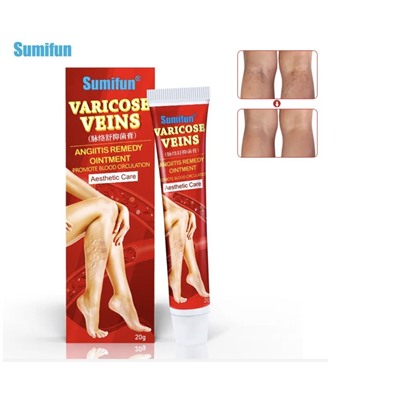 Мазь против варикозного расширения вен Sumifun Varicose Veins Angiitis Remedy Ointment 20g
